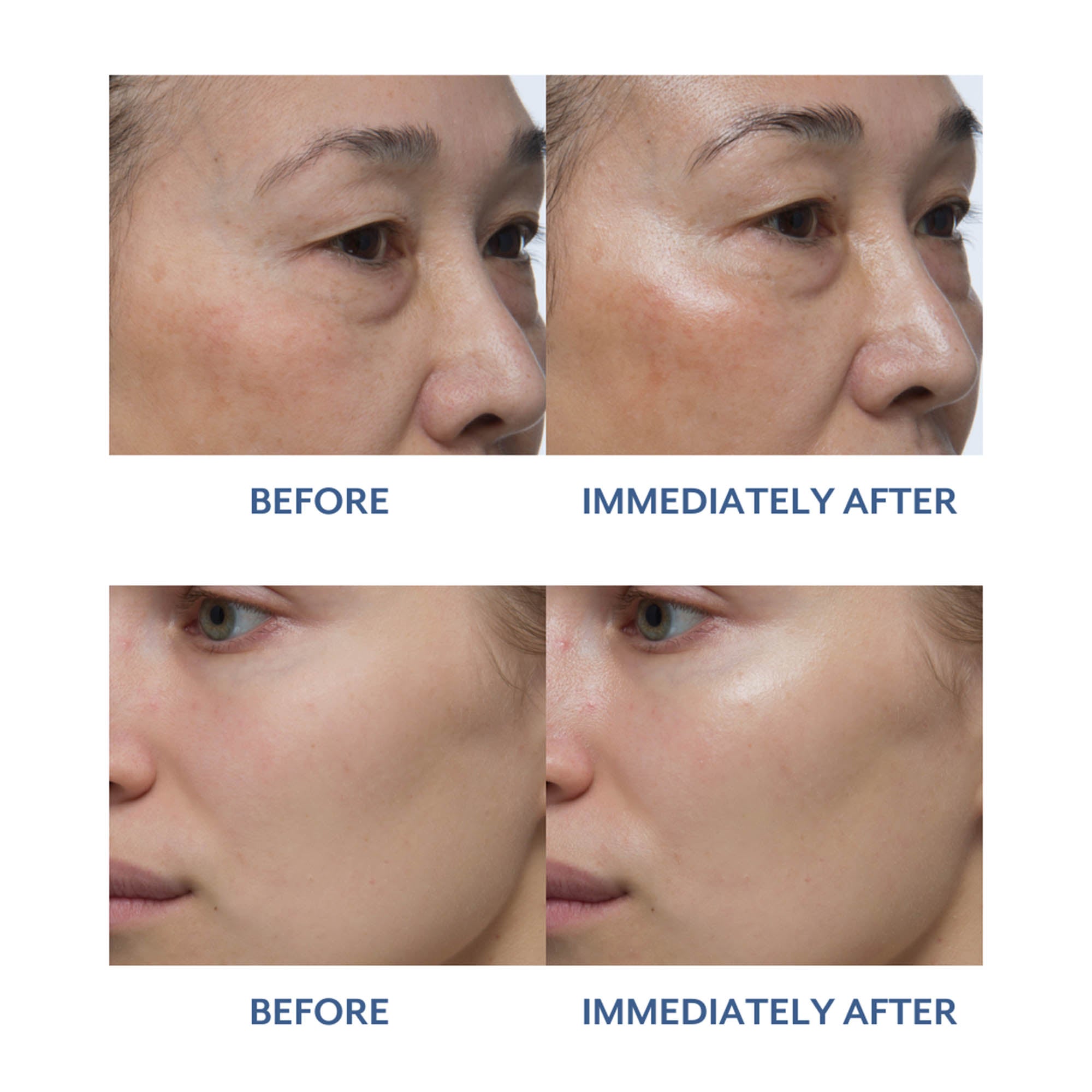 Before and Immediately after images of using Dew Cream